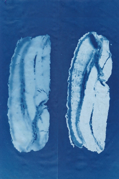 1 1